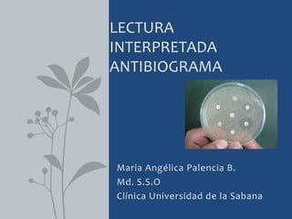 Maria Angélica Palencia B.
Md. S.S.O
Clínica Universidad de la Sabana
LECTURA
INTERPRETADA
ANTIBIOGRAMA
 