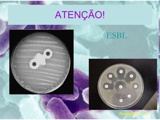 ATENÇÃO! ESBL Rodrigues, A. C. 