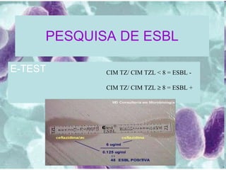 PESQUISA DE ESBL E-TEST  CIM TZ/ CIM TZL < 8 = ESBL - CIM TZ/ CIM TZL    8 = ESBL + 