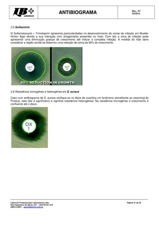 ANTIBIOGRAMA Rev.: 07
03/2013
Laborclin Produtos para Laboratórios Ltda.
Rua Cassemiro de Abreu, 521 – CEP 83.321-210
0800-410027 – sac@laborlcin.com.br
Página 31 de 32
2.5 Sulfazotrim
O Sulfametoxazol + Trimetoprim apresenta particularidades no desenvolvimento de zonas de inibição em Mueller
Hinton Agar devido a sua interação com antagonistas presentes no meio. Com isto a zona de inibição pode
apresentar uma diminuição gradual de crescimento até indicar a completa inibição. A medida do halo deve
considerar a região aonde se observou uma redução de cerca de 80% do crescimento.
2.6 Resistência homogênea e heterogênea em S. aureus
Caso num antibiograma de S. aureus verifique-se no disco de oxacilina um fenômeno semelhante ao swarming do
Proteus, este fato é significativo e significa resistência heterogênea. Na resistência homogênea o crescimento é
confluente até o disco.
 