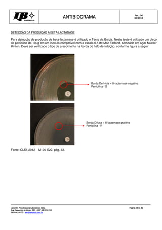 ANTIBIOGRAMA
ANTIBIOGRAMA
ANTIBIOGRAMA
ANTIBIOGRAMA Rev.: 0
Rev.: 0
Rev.: 0
Rev.: 06
6
6
6
0
0
0
03
3
3
3/201
/201
/201
/2012
2
2
2
Laborclin Produtos para Laboratórios Ltda.
Laborclin Produtos para Laboratórios Ltda.
Laborclin Produtos para Laboratórios Ltda.
Laborclin Produtos para Laboratórios Ltda.
Rua Cassemiro de Abreu, 521
Rua Cassemiro de Abreu, 521
Rua Cassemiro de Abreu, 521
Rua Cassemiro de Abreu, 521 –
–
–
– CEP 83.321
CEP 83.321
CEP 83.321
CEP 83.321-
-
-
-210
210
210
210
0800
0800
0800
0800-
-
-
-410027
410027
410027
410027 –
–
–
– sac@laborlcin.com.br
sac@laborlcin.com.br
sac@laborlcin.com.br
sac@laborlcin.com.br
Página
Página
Página
Página 23
23
23
23 de
de
de
de 32
32
32
32
DETECÇÃO DA PRODUÇÃO A BETA-LACTAMASE
Para detecção de produção de beta-lactamase é utilizado o Teste da Borda. Neste teste é utilizado um disco
de penicilina de 10µg em um inoculo compatível com a escala 0,5 de Mac Farland, semeado em Agar Mueller
Hinton. Deve ser verificado o tipo de crescimento na borda do halo de inibição, conforme figura a seguir:
Fonte: CLSI, 2012 – M100-S22, pág. 83.
Borda Definida = ß-lactamase negativa
Penicilina - S
Borda Difusa = ß-lactamase positiva
Penicilina - R
 