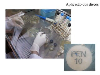 Aplicação dos discos
 