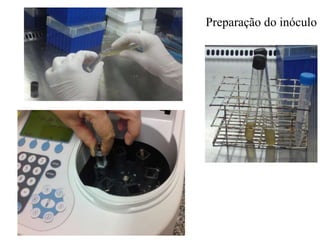 Preparação do inóculo
 