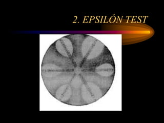 2. EPSILÓN TEST
 