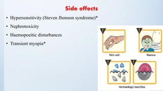 Side effects
• Hypersensitivity (Steven Jhonson syndrome)*
• Nephrotoxicity
• Haemopoeitic disturbances
• Transient myopia*
 
