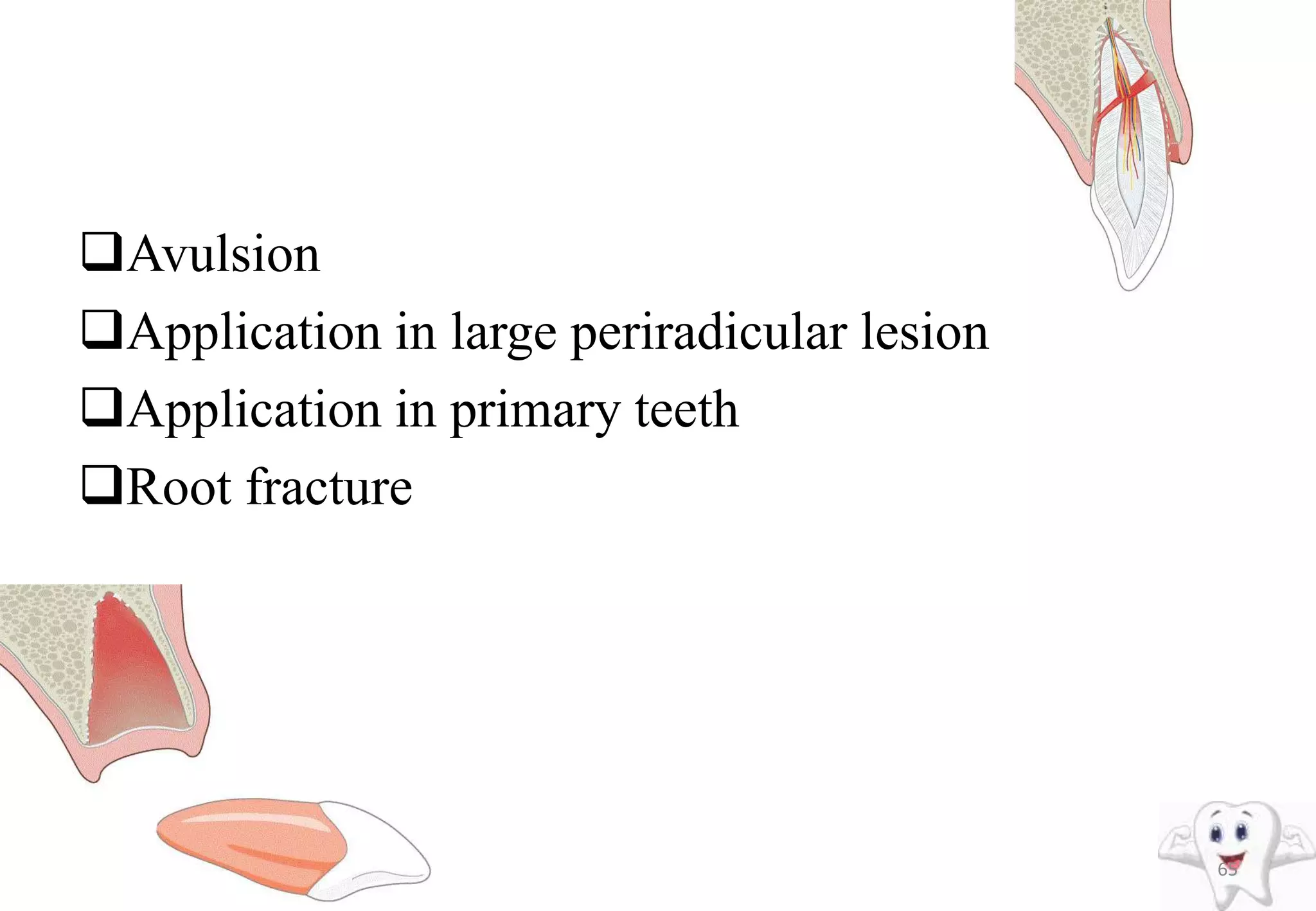 Avulsion
Application in large periradicular lesion
Application in primary teeth
Root fracture
65
 