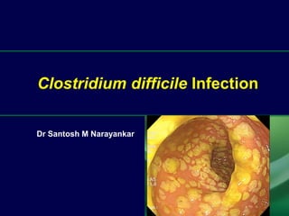 Dr Santosh M Narayankar
Clostridium difficile Infection
 