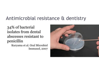 Antimicrobial resistance & dentistry
34% of bacterial
isolates from dental
abscesses resistant to
penicillin
Kuryama et al. Oral Microbiol
Immunol, 2007
 