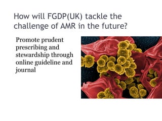 How will FGDP(UK) tackle the
challenge of AMR in the future?
Promote prudent
prescribing and
stewardship through
online guideline and
journal
 