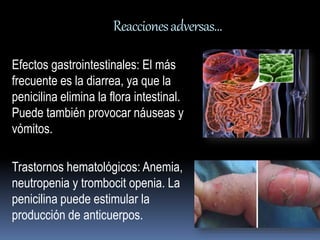 Reacciones adversas… 
Efectos gastrointestinales: El más 
frecuente es la diarrea, ya que la 
penicilina elimina la flora intestinal. 
Puede también provocar náuseas y 
vómitos. 
Trastornos hematológicos: Anemia, 
neutropenia y trombocit openia. La 
penicilina puede estimular la 
producción de anticuerpos. 
 