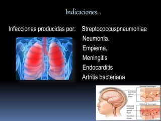 Indicaciones… 
Infecciones producidas por: Streptococcuspneumoniae 
Neumonía. 
Empiema. 
Meningitis 
Endocarditis 
Artritis bacteriana 
 