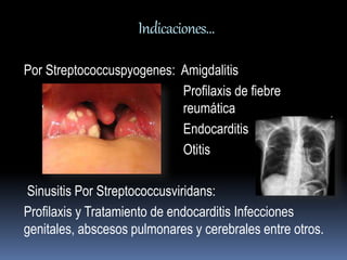 Indicaciones… 
Por Streptococcuspyogenes: Amigdalitis 
Profilaxis de fiebre 
reumática 
Endocarditis 
Otitis 
Sinusitis Por Streptococcusviridans: 
Profilaxis y Tratamiento de endocarditis Infecciones 
genitales, abscesos pulmonares y cerebrales entre otros. 
 