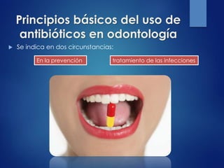 Principios básicos del uso de
antibióticos en odontología
 Se indica en dos circunstancias:
En la prevención tratamiento de las infecciones
 