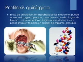 Profilaxis quirúrgica
 El uso de antibióticos en la profilaxis de las infecciones puede
ocurrir en la región operada , como en el caso de cirugías de
terceros molares retenidos, cirugías paraendodóncicas y
periodontales y también en cirugías de implantes dentales.
 