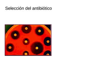 Selección del antibiótico
 