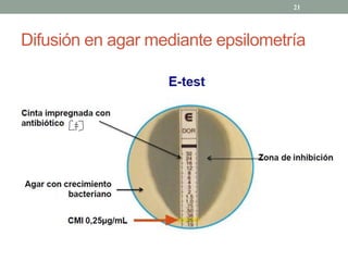 Difusión en agar mediante epsilometría
21
LA
 