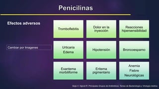 Seija V, Vignoli R. Principales Grupos de Antibióticos. Temas de Bacteriología y Virología médica.
Efectos adversos
Tromboflebitis
Dolor en la
inyección
Reacciones
hipersensibilidad
Urticaria
Edema
Hipotensión Broncoespamo
Exantema
morbiliforme
Eritema
pigmentario
Anemia
Fiebre
Neurológicas
Cambiar por Imagenes
 
