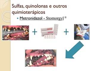Sulfas, quinolonas e outros
quimioterápicos
 Metronidazol - Stomorgyl ®
 