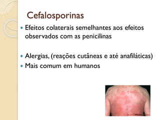 Cefalosporinas
 Efeitos colaterais semelhantes aos efeitos
observados com as penicilinas
 Alergias, (reações cutâneas e até anafiláticas)
 Mais comum em humanos
 