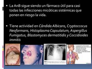  La AnB sigue siendo un fármaco útil para casi
todas las infecciones micóticas sistémicas que
ponen en riesgo la vida.
 Tiene actividad en Cándida Albicans, Cryptoccocus
Neoformans, Histoplasma Capsulatum, Aspergillus
Fumigatus, Blastomyces dermatitidis y Coccidioides
immitis
 