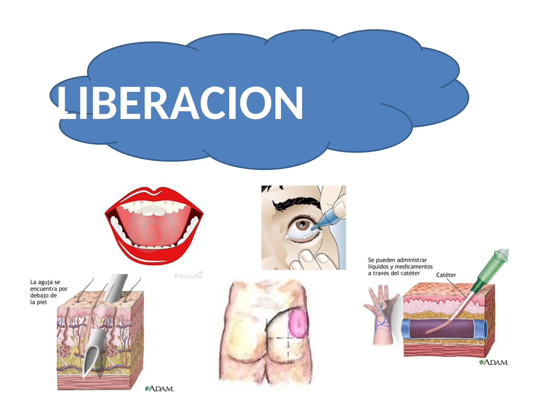 LIBERACION
 
