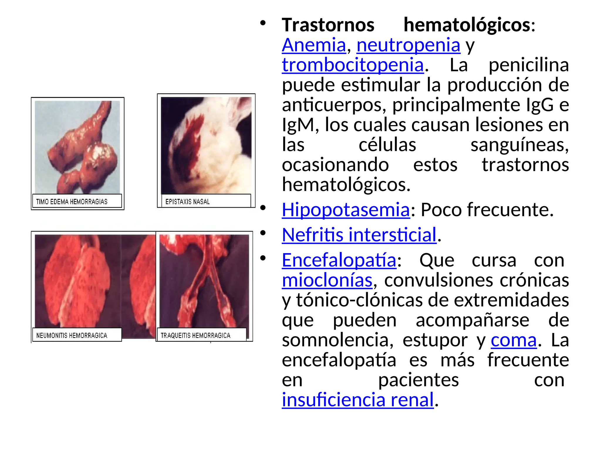• Trastornos hematológicos:
Anemia, neutropenia y
trombocitopenia. La penicilina
puede estimular la producción de
anticuerpos, principalmente IgG e
IgM, los cuales causan lesiones en
las células sanguíneas,
ocasionando estos trastornos
hematológicos.
• Hipopotasemia: Poco frecuente.
• Nefritis intersticial.
• Encefalopatía: Que cursa con
mioclonías, convulsiones crónicas
y tónico-clónicas de extremidades
que pueden acompañarse de
somnolencia, estupor y coma. La
encefalopatía es más frecuente
en pacientes con
insuficiencia renal.
 