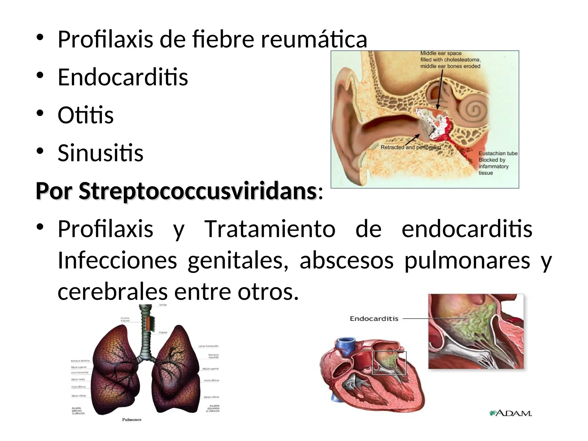 • Profilaxis de fiebre reumática
• Endocarditis
• Otitis
• Sinusitis
Por Streptococcusviridans
Por Streptococcusviridans:
• Profilaxis y Tratamiento de endocarditis
Infecciones genitales, abscesos pulmonares y
cerebrales entre otros.
 