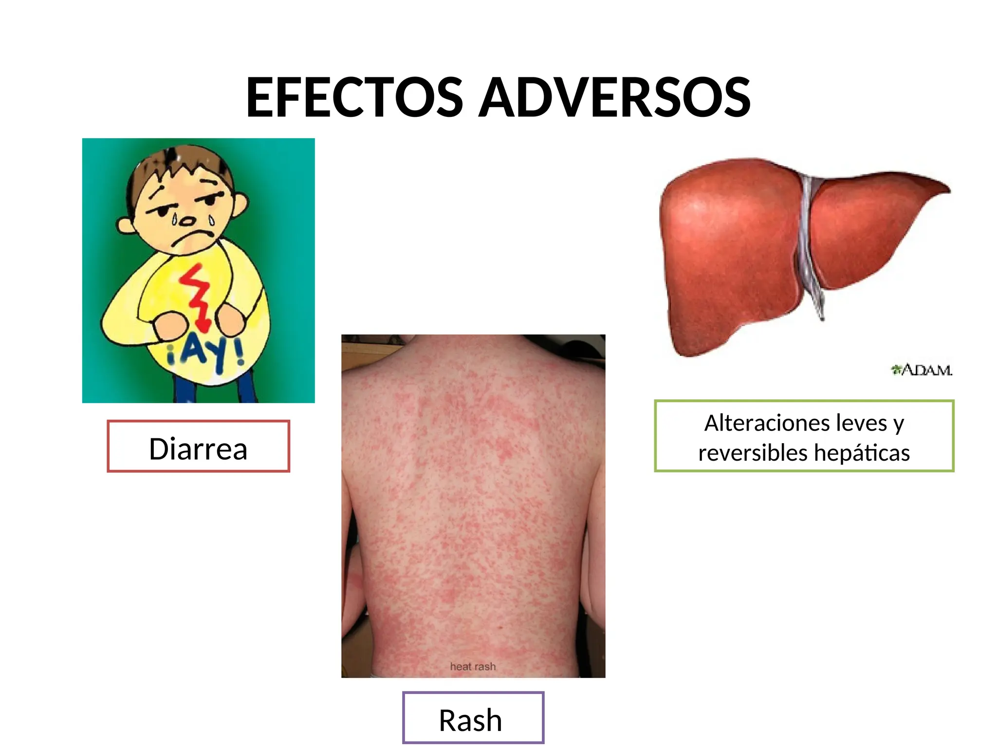 EFECTOS ADVERSOS
Rash
Diarrea
Alteraciones leves y
reversibles hepáticas
 