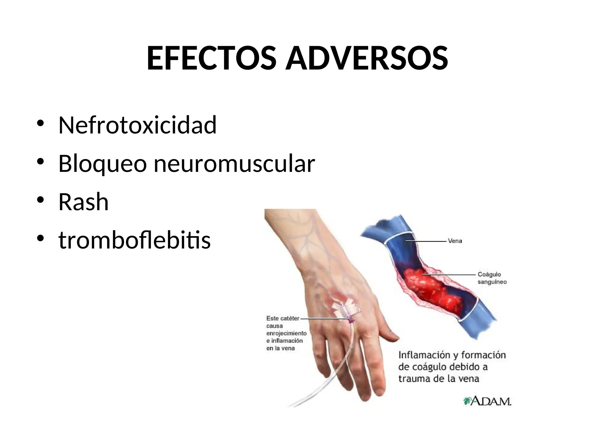 EFECTOS ADVERSOS
• Nefrotoxicidad
• Bloqueo neuromuscular
• Rash
• tromboflebitis
 