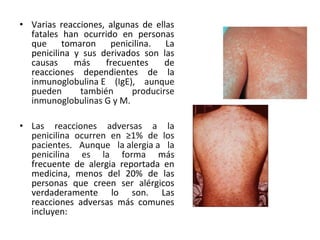• Varias reacciones, algunas de ellas
  fatales han ocurrido en personas
  que tomaron penicilina. La
  penicilina y sus derivados son las
  causas     más    frecuentes    de
  reacciones dependientes de la
  inmunoglobulina E (IgE), aunque
  pueden      también     producirse
  inmunoglobulinas G y M.

• Las reacciones adversas a la
  penicilina ocurren en ≥1% de los
  pacientes. Aunque la alergia a la
  penicilina es la forma más
  frecuente de alergia reportada en
  medicina, menos del 20% de las
  personas que creen ser alérgicos
  verdaderamente lo son. Las
  reacciones adversas más comunes
  incluyen:
 