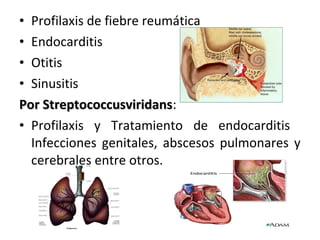 • Profilaxis de fiebre reumática
• Endocarditis
• Otitis
• Sinusitis
Por Streptococcusviridans:
    Streptococcusviridans
• Profilaxis y Tratamiento de endocarditis
  Infecciones genitales, abscesos pulmonares y
  cerebrales entre otros.
 