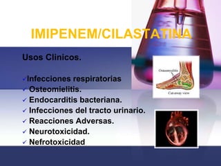 IMIPENEM/CILASTATINA
Usos Clinicos.

Infecciones respiratorias
 Osteomielitis.
 Endocarditis bacteriana.
 Infecciones del tracto urinario.
 Reacciones Adversas.
 Neurotoxicidad.
 Nefrotoxicidad
 