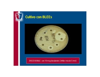 Antibioticoterapia y resistencia microbiana