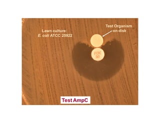 Antibioticoterapia y resistencia microbiana