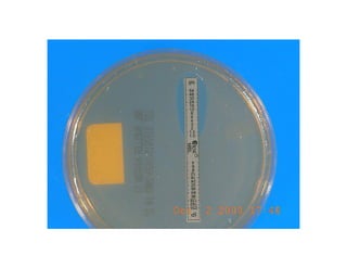 Antibioticoterapia y resistencia microbiana