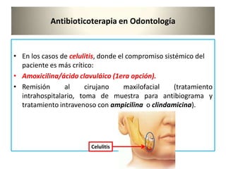Antibioticoterapia en Odontología
• En los casos de celulitis, donde el compromiso sistémico del
paciente es más crítico:
• Amoxicilina/ácido clavuláico (1era opción).
• Remisión al cirujano maxilofacial (tratamiento
intrahospitalario, toma de muestra para antibiograma y
tratamiento intravenoso con ampicilina o clindamicina).
Celulitis
 