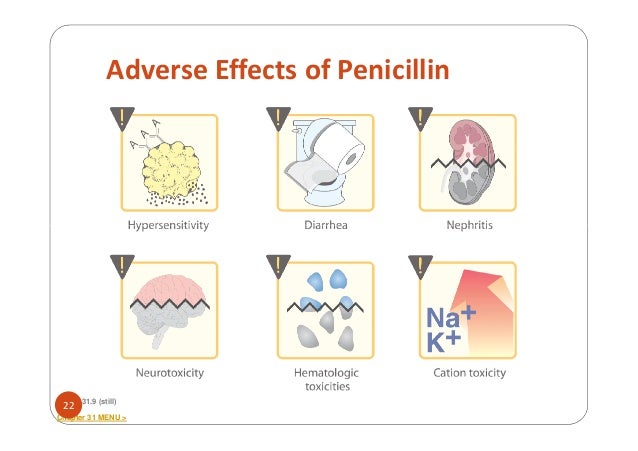 Amoxillian Side Effects