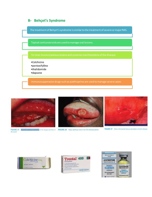 Antibiotic prophylaxis for infective endocartitis