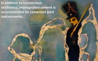 Antibiotic prophylaxis in surgery 