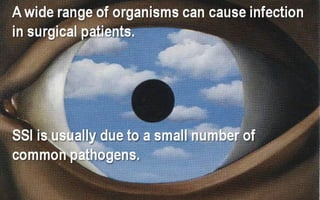 Antibiotic prophylaxis in surgery 