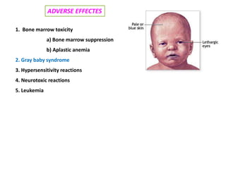 1. Bone marrow toxicity
a) Bone marrow suppression
b) Aplastic anemia
2. Gray baby syndrome
3. Hypersensitivity reactions
4. Neurotoxic reactions
5. Leukemia
ADVERSE EFFECTES
 