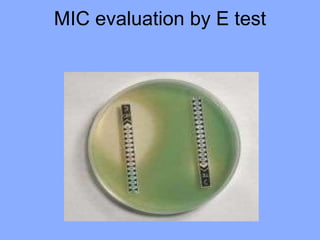 MIC evaluation by E test
 