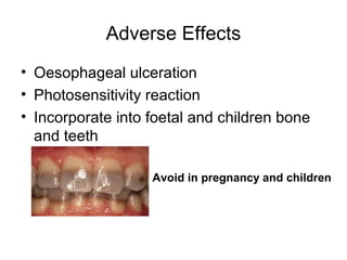 Adverse Effects
• Oesophageal ulceration
• Photosensitivity reaction
• Incorporate into foetal and children bone
and teeth
Avoid in pregnancy and children
 