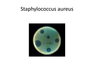 Staphylococcus aureus
 