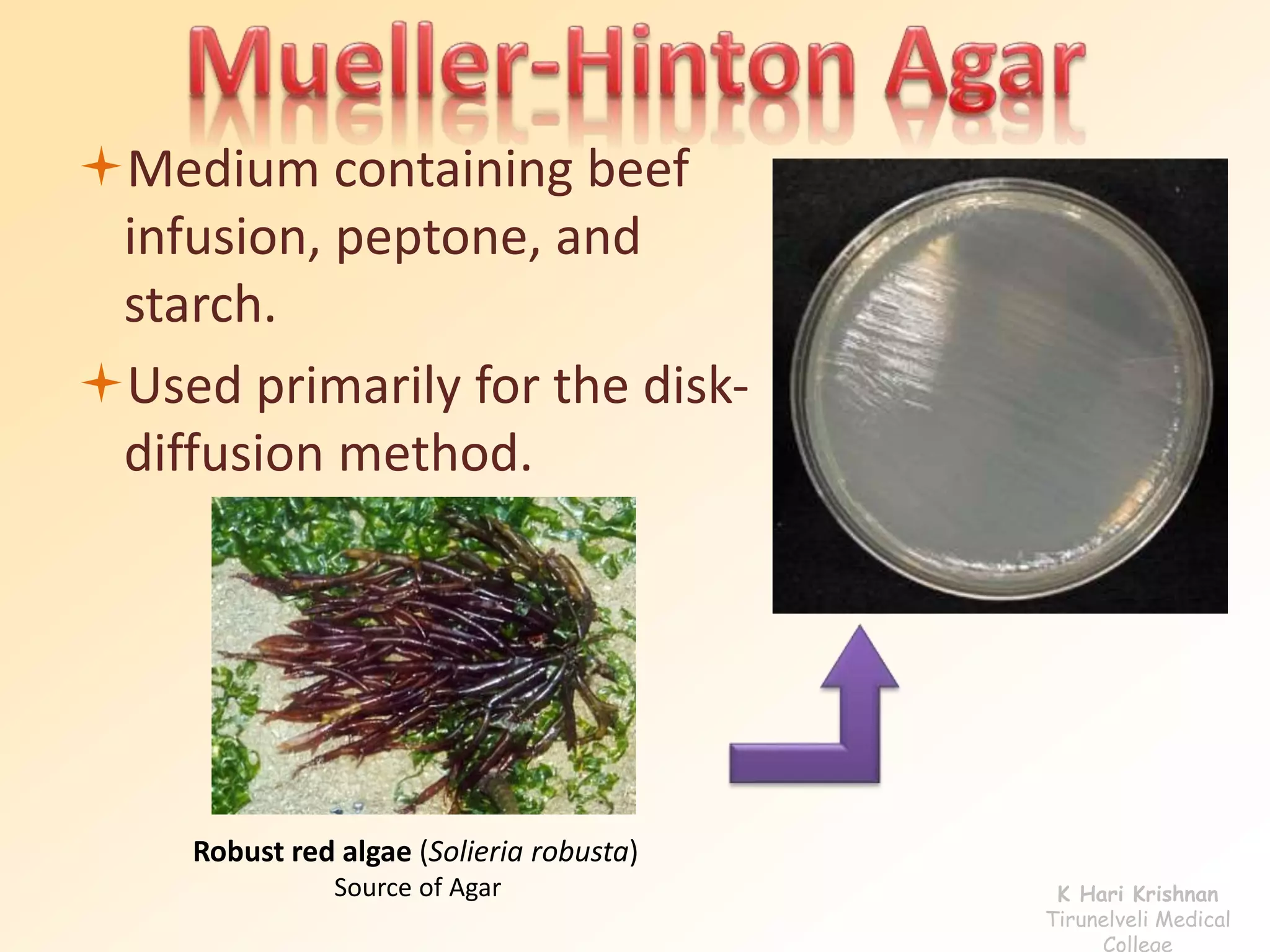 Medium containing beef 
infusion, peptone, and 
starch. 
Used primarily for the disk-diffusion 
method. 
Robust red algae (Solieria robusta) 
Source of Agar K Hari Krishnan 
Tirunelveli Medical 
College 
 