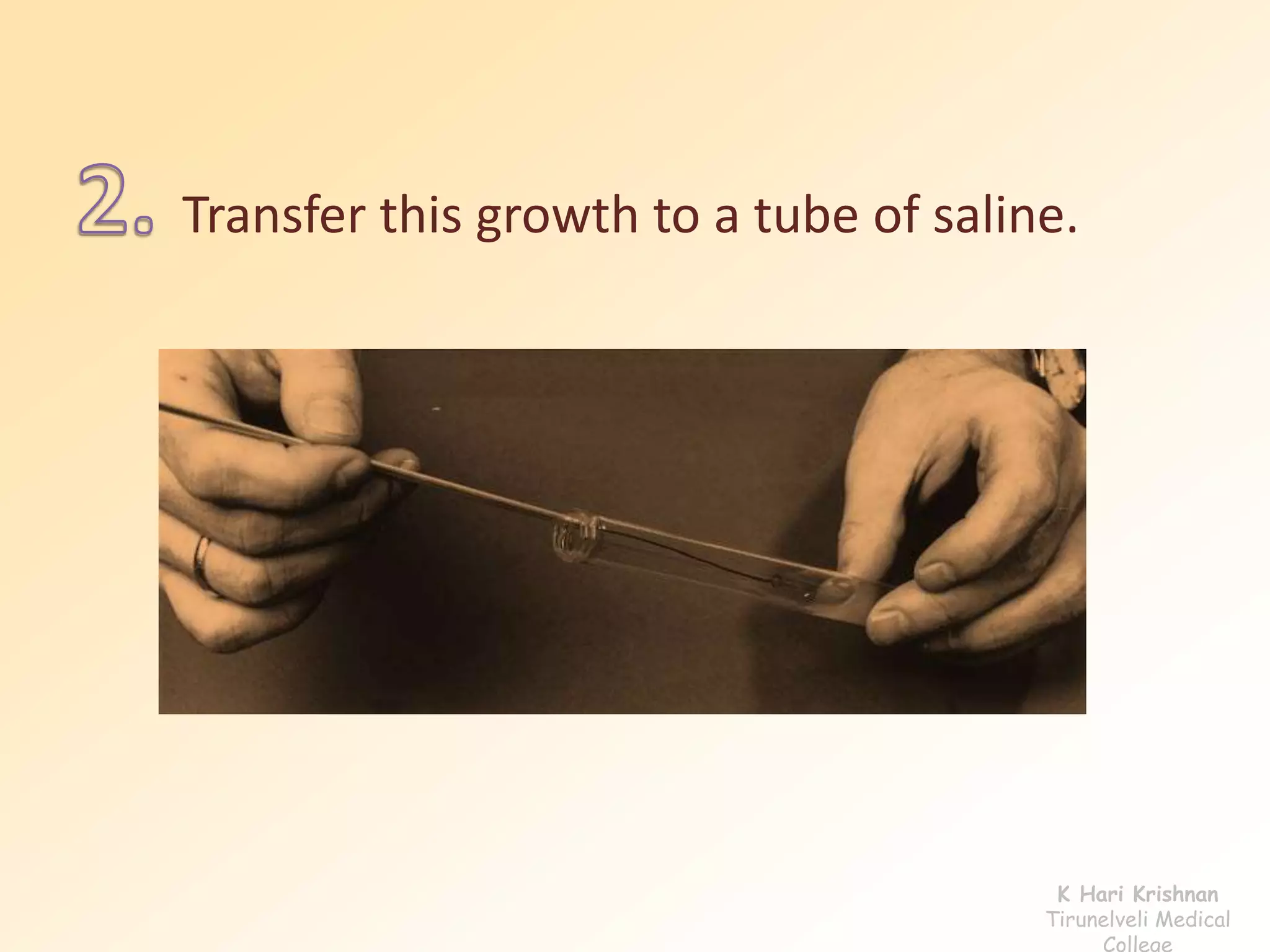 Transfer this growth to a tube of saline. 
K Hari Krishnan 
Tirunelveli Medical 
College 
 