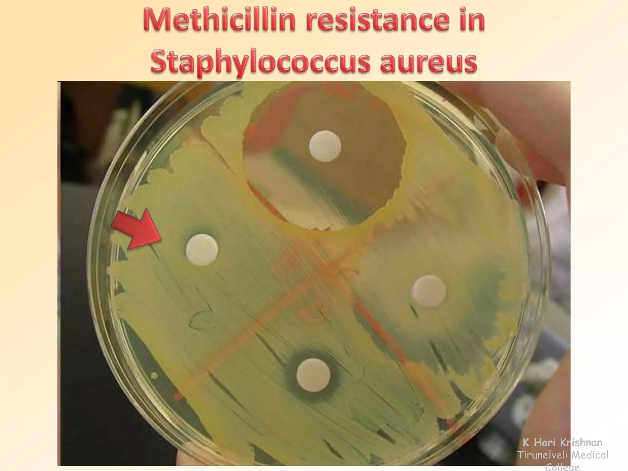 K Hari Krishnan 
Tirunelveli Medical 
College 
 
