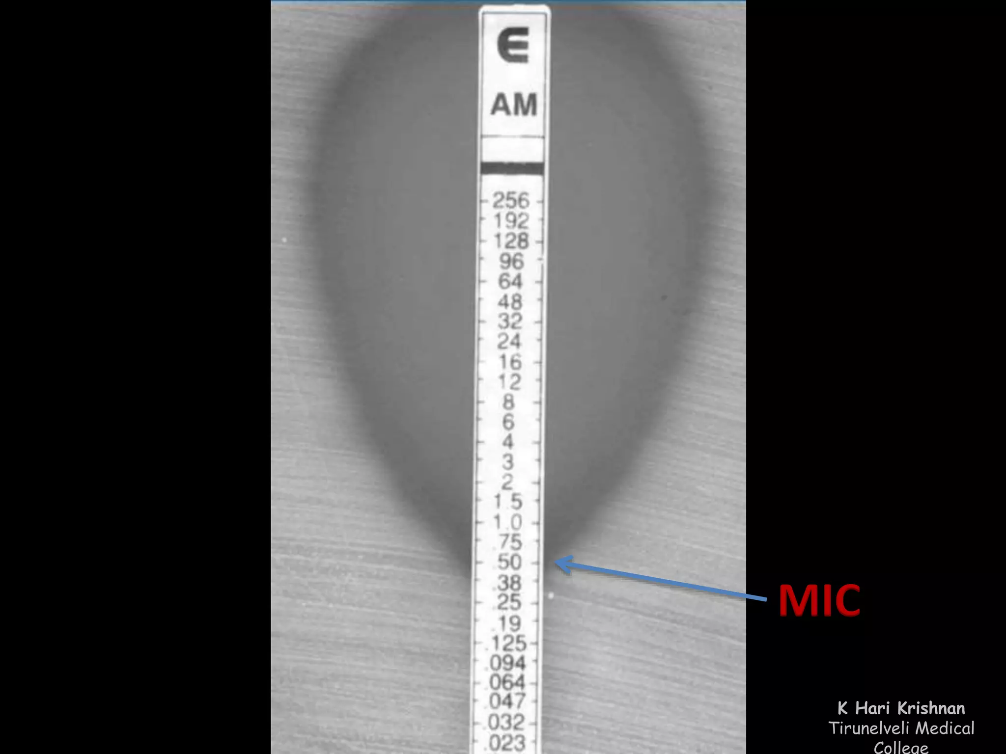 MIC 
K Hari Krishnan 
Tirunelveli Medical 
College 
 