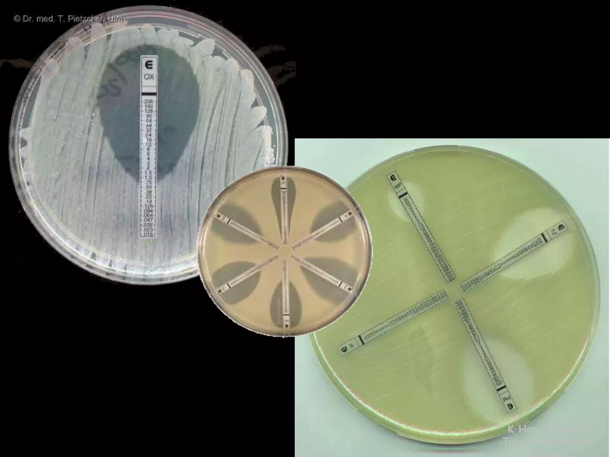 K Hari Krishnan 
Tirunelveli Medical 
College 
 