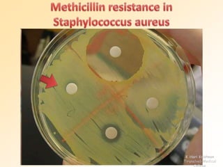 K Hari Krishnan 
Tirunelveli Medical 
College 
 